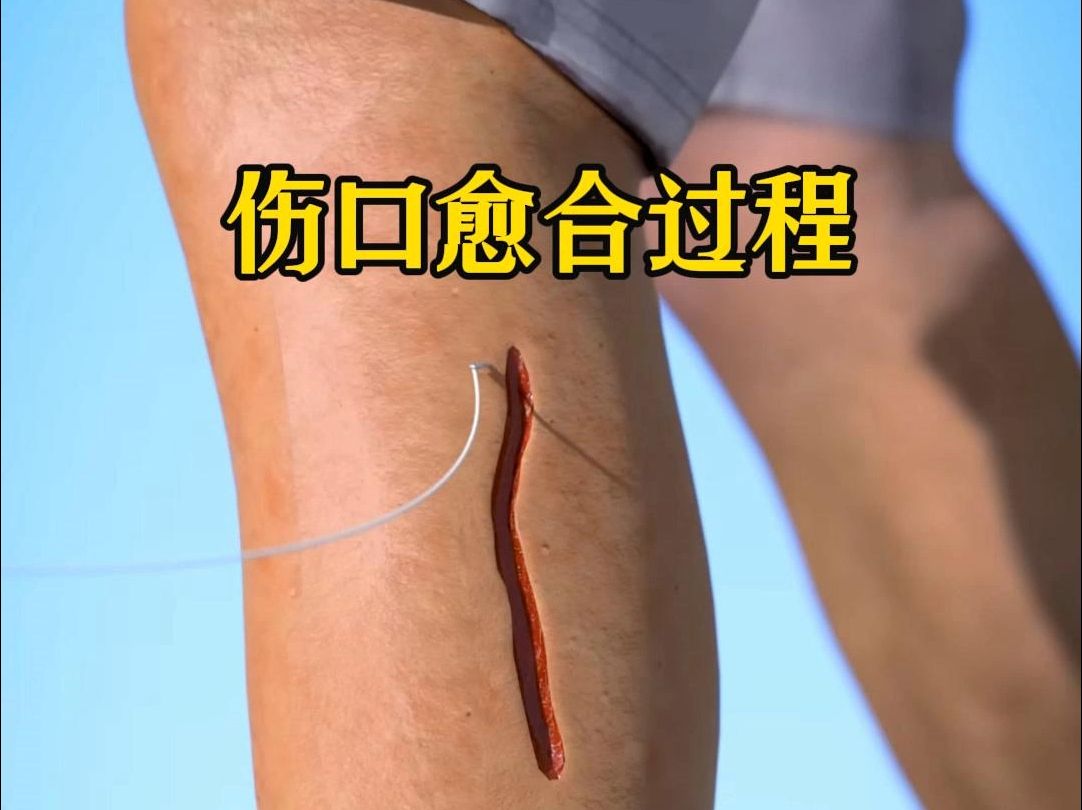 伤口愈合过程
