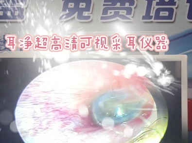 设备户外跑江湖可视采耳仪器采耳专用仪器超高清可视采耳仪可视耳内镜
