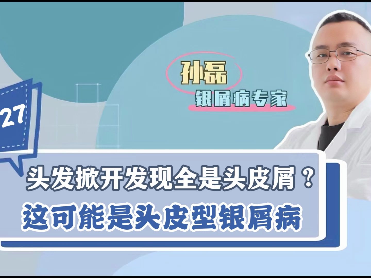 头皮屑特别多,以为是没洗干净,其实可能是头皮型银屑病惹的祸哔哩哔哩bilibili