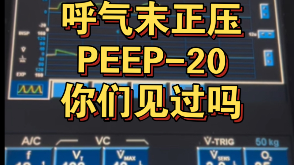 呼气末正压(PEEP)20你们见过吗?我第一次见,太夸张了哔哩哔哩bilibili