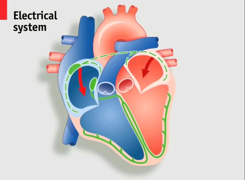 心脏起搏器工作原理哔哩哔哩bilibili