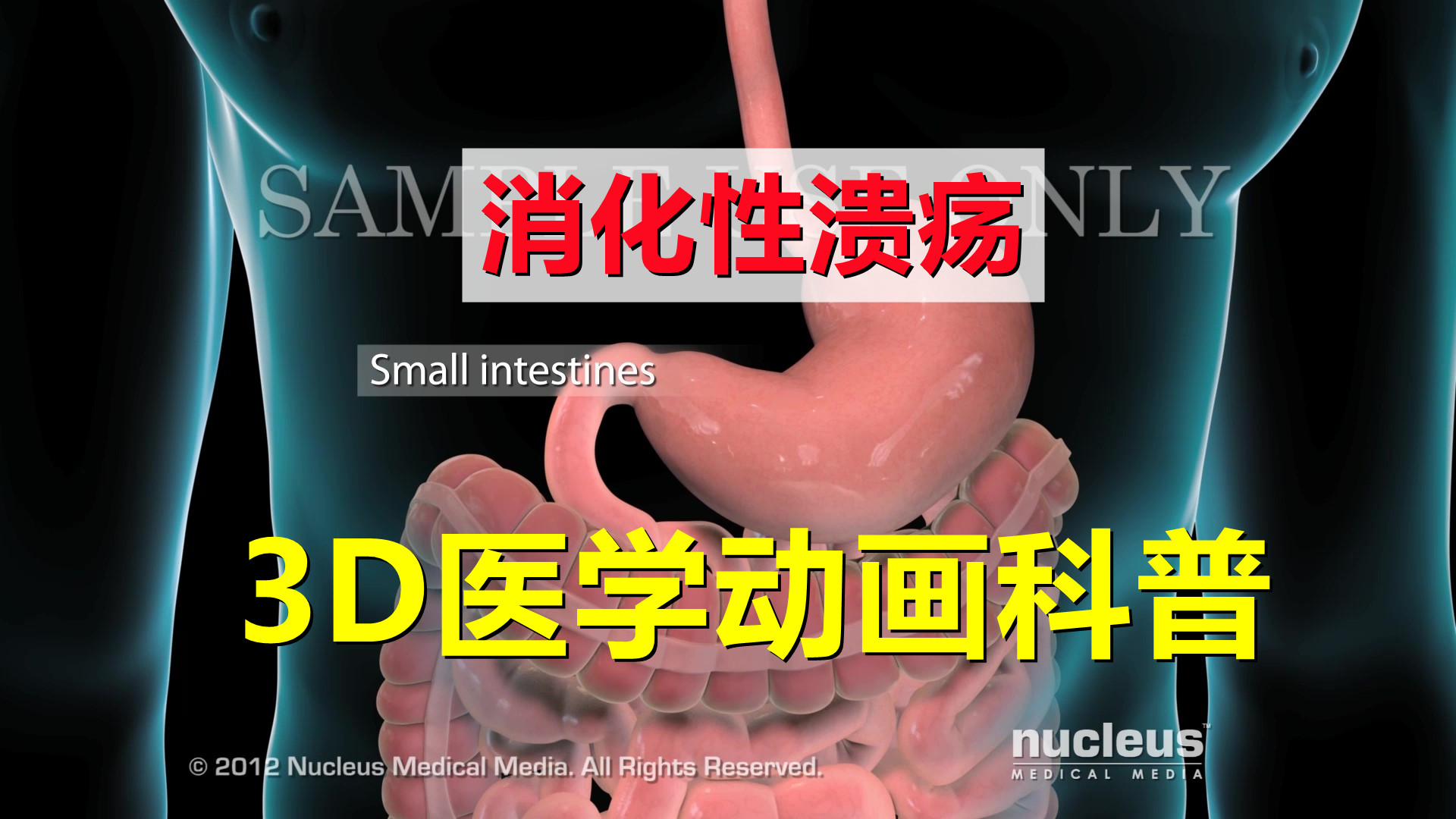 [图]【3D医学动画科普】消化性溃疡（中英双语字幕）