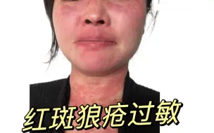 Video herunterladen: 单亲妈妈，严重过敏挂急诊，心疼孩子过年天天陪妈妈跑医院！