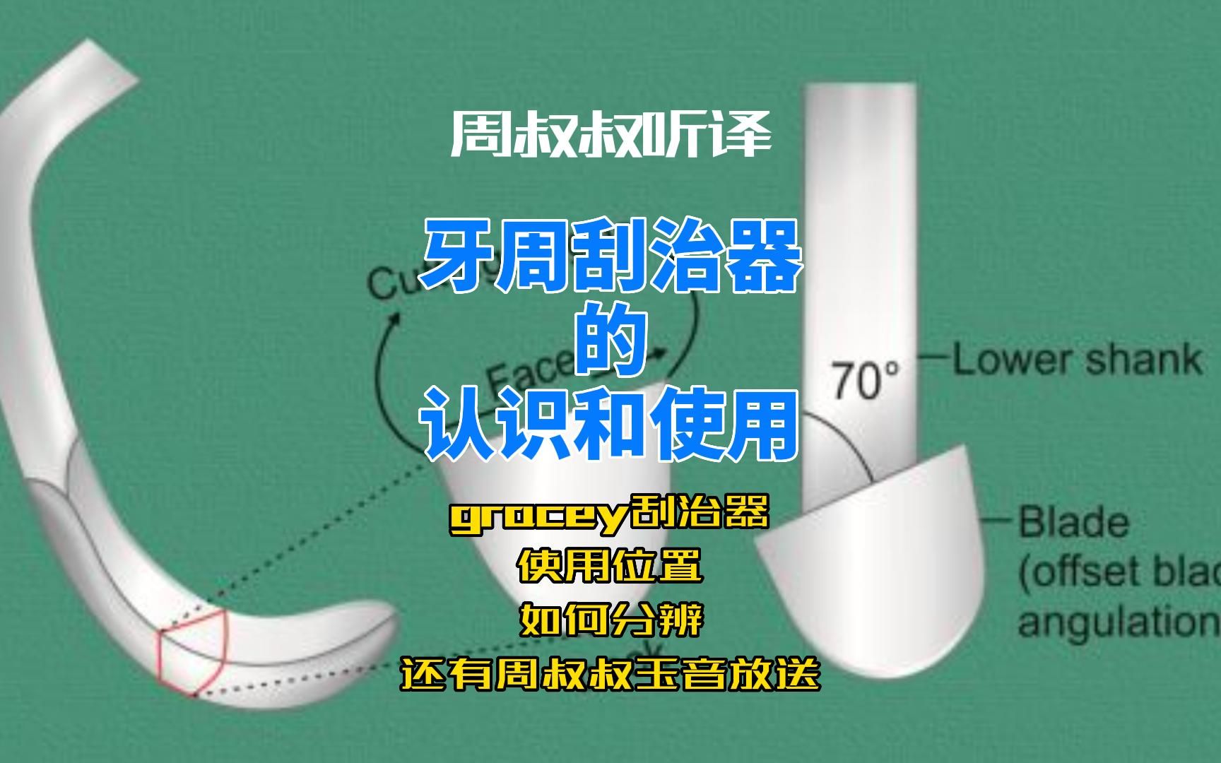 可能是牙周刮治的最容易理解最全面的讲解了(拼了好几个视频翻译的 不给叔点个赞吗)哔哩哔哩bilibili