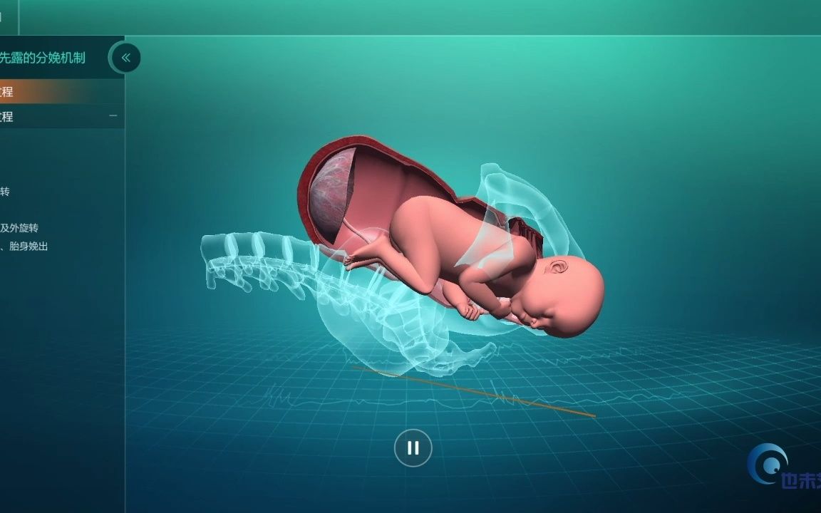 [图]极倍职教医学类分娩过程软件演示