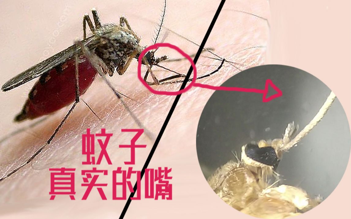 蚊子咬人的嘴长啥样?显微镜下一看,真是头皮发麻