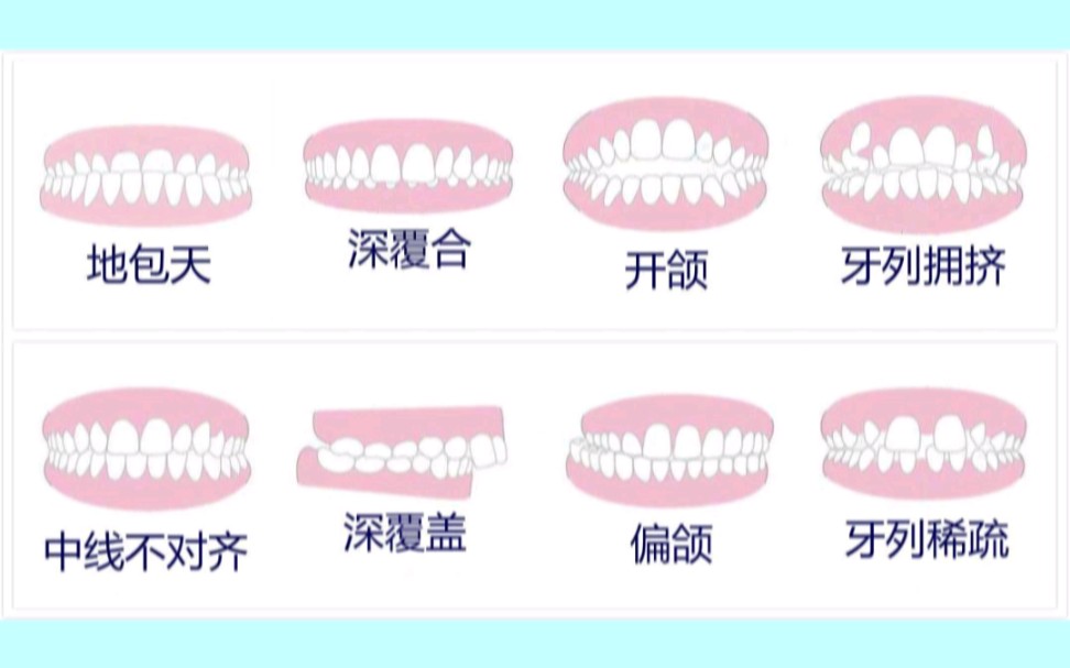 让我告诉你 你的牙齿矫正要多少钱哔哩哔哩bilibili