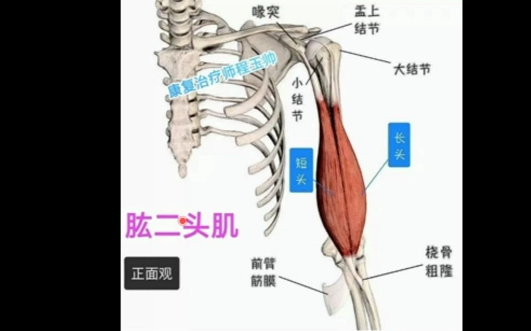 肱二头肌腱鞘炎的症状图片