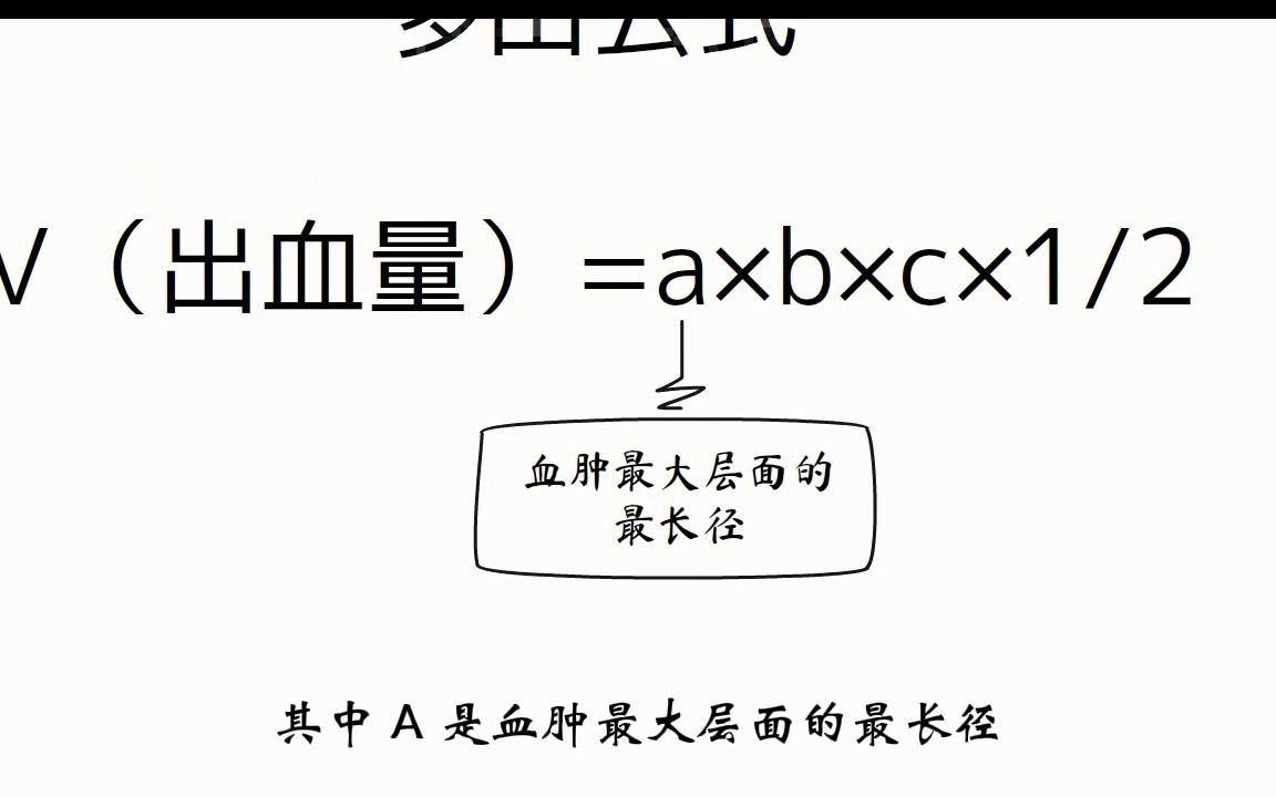 多田公式计算脑出血量_哔哩哔哩_bilibili