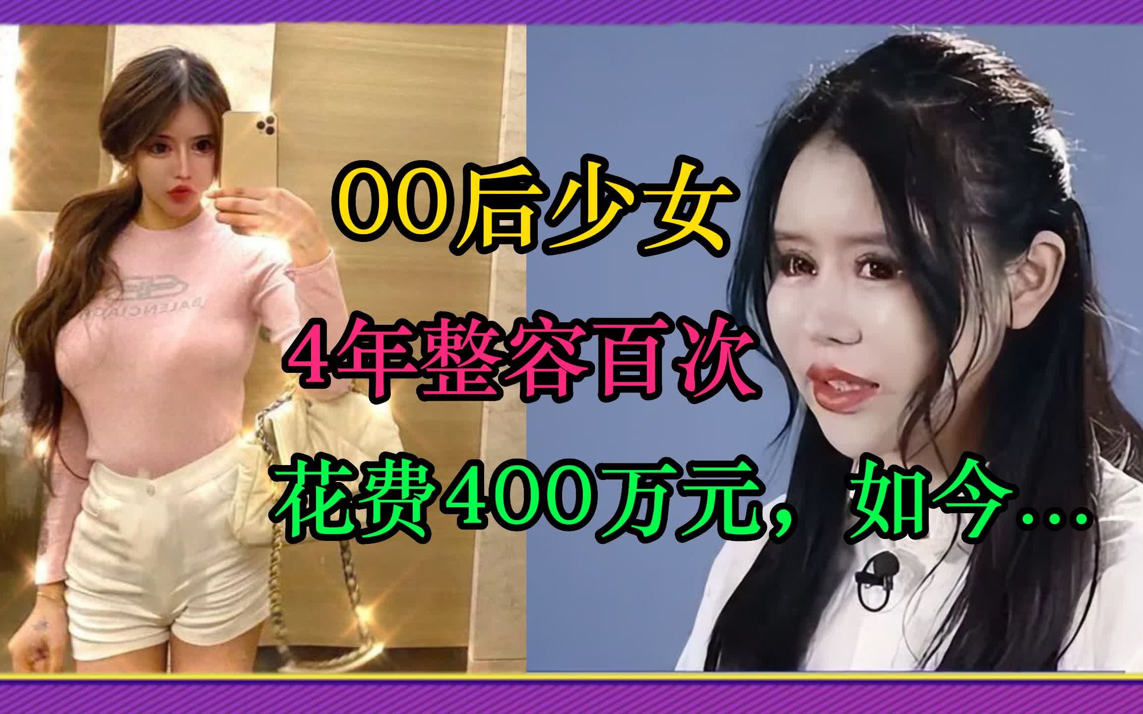 00后少女周楚娜,4年整容上百次,花费400多万元,如今怎么样了呢哔哩哔哩bilibili