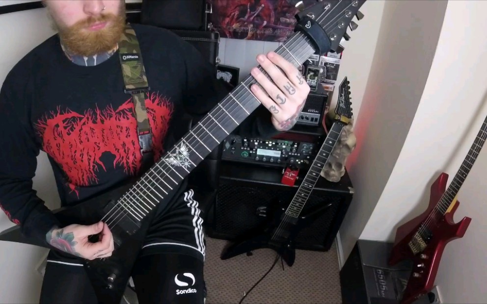 guitarcovercephalotripsy碎颅术uterovaginalinsertionofextirpated