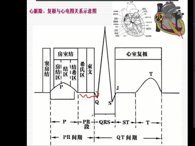 mortara心电图机图解图片