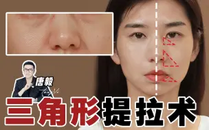 Descargar video: 【唐毅】“三八线”消失大法 拒绝垮脸 优化五官