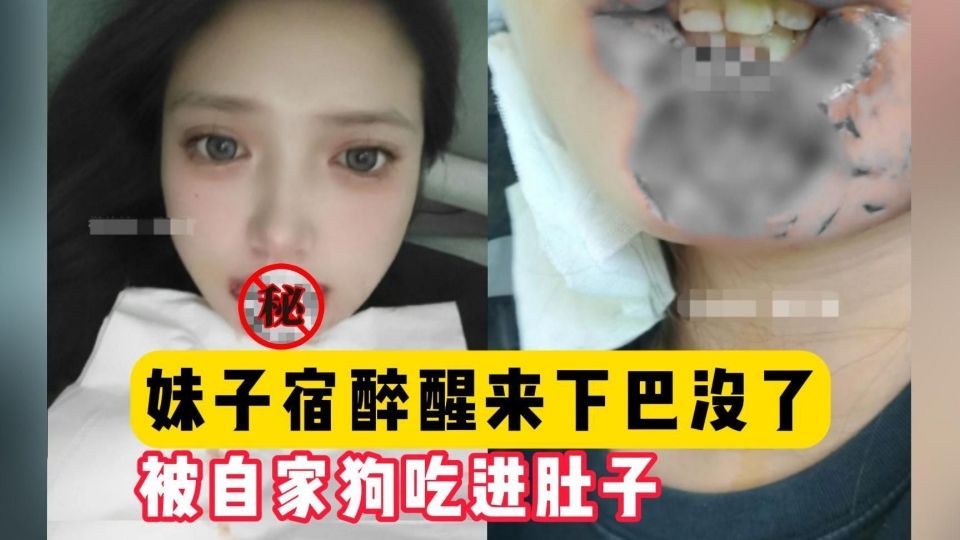 妹子宿醉被自家狗咬，直接下巴都吃了，惨不忍睹