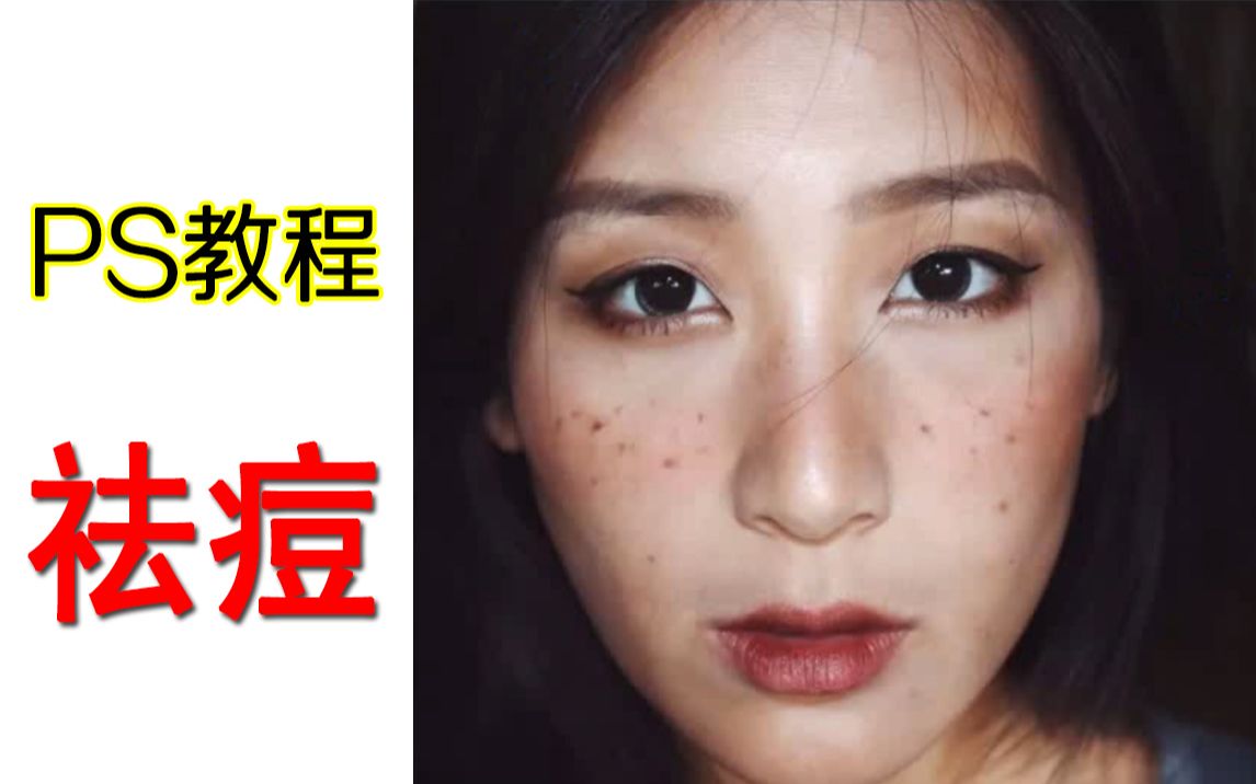 活动作品ps教程ps如何祛痘你不会我教你啊