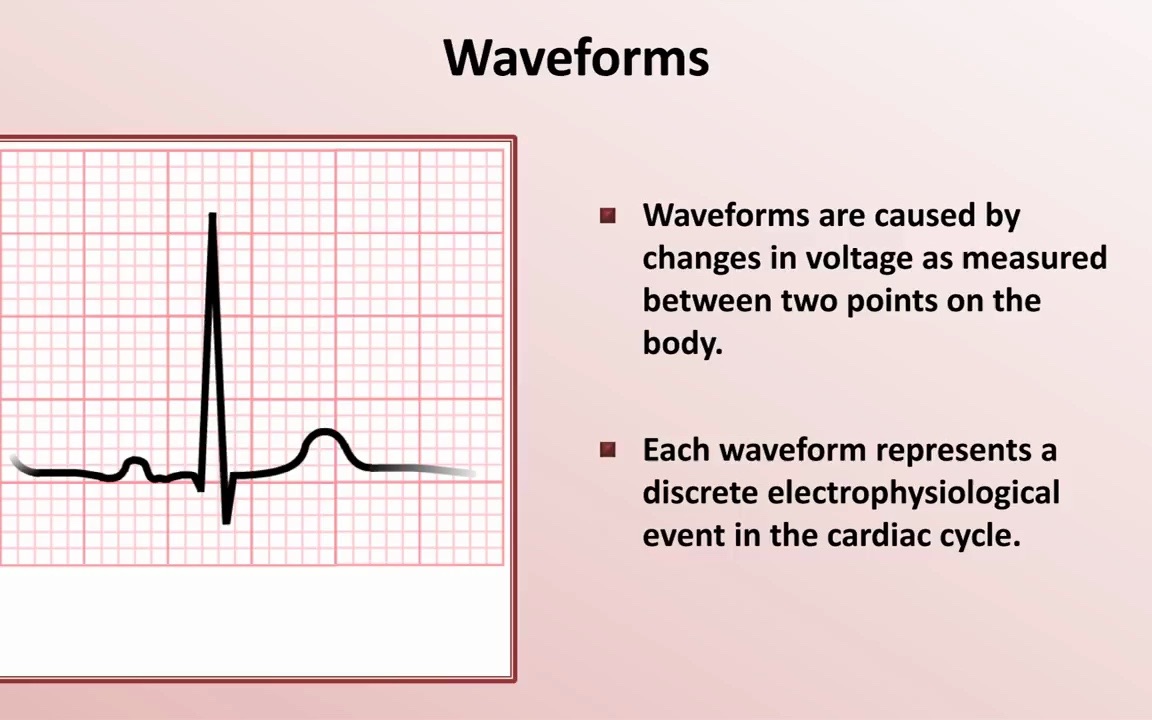 心电图基础Intro to EKG Interpretation  Waveforms, Segments, and Intervals哔哩哔哩bilibili