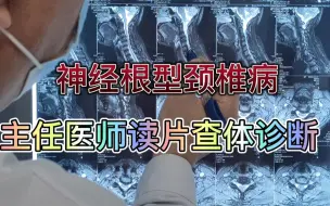 Download Video: 针灸科病案精讲，上肢、肩背疼痛分析，颈椎病诊疗思路解析