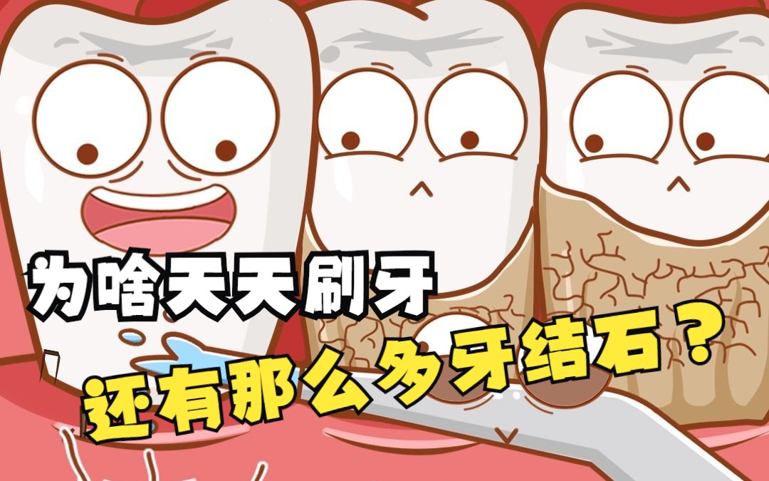 为啥每天刷牙,还有那么多牙结石?