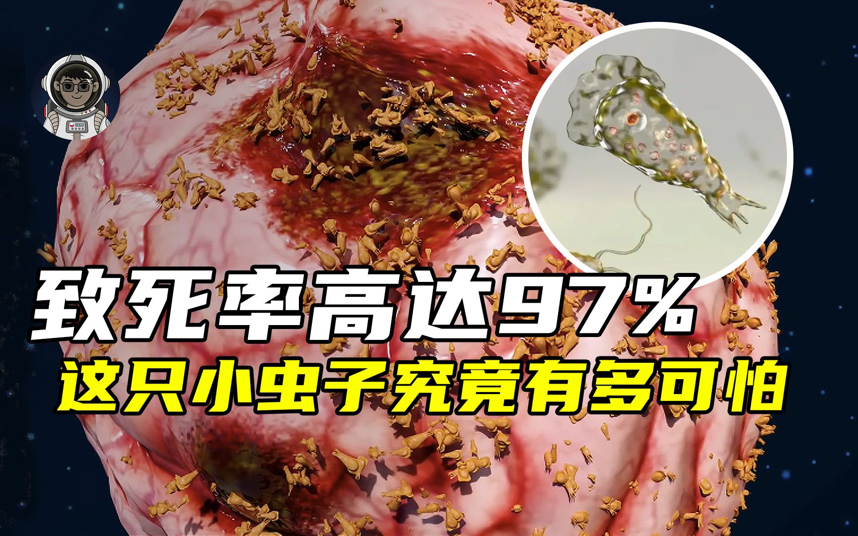 [图]致死率高达97%，食脑虫是如何蚕食大脑的