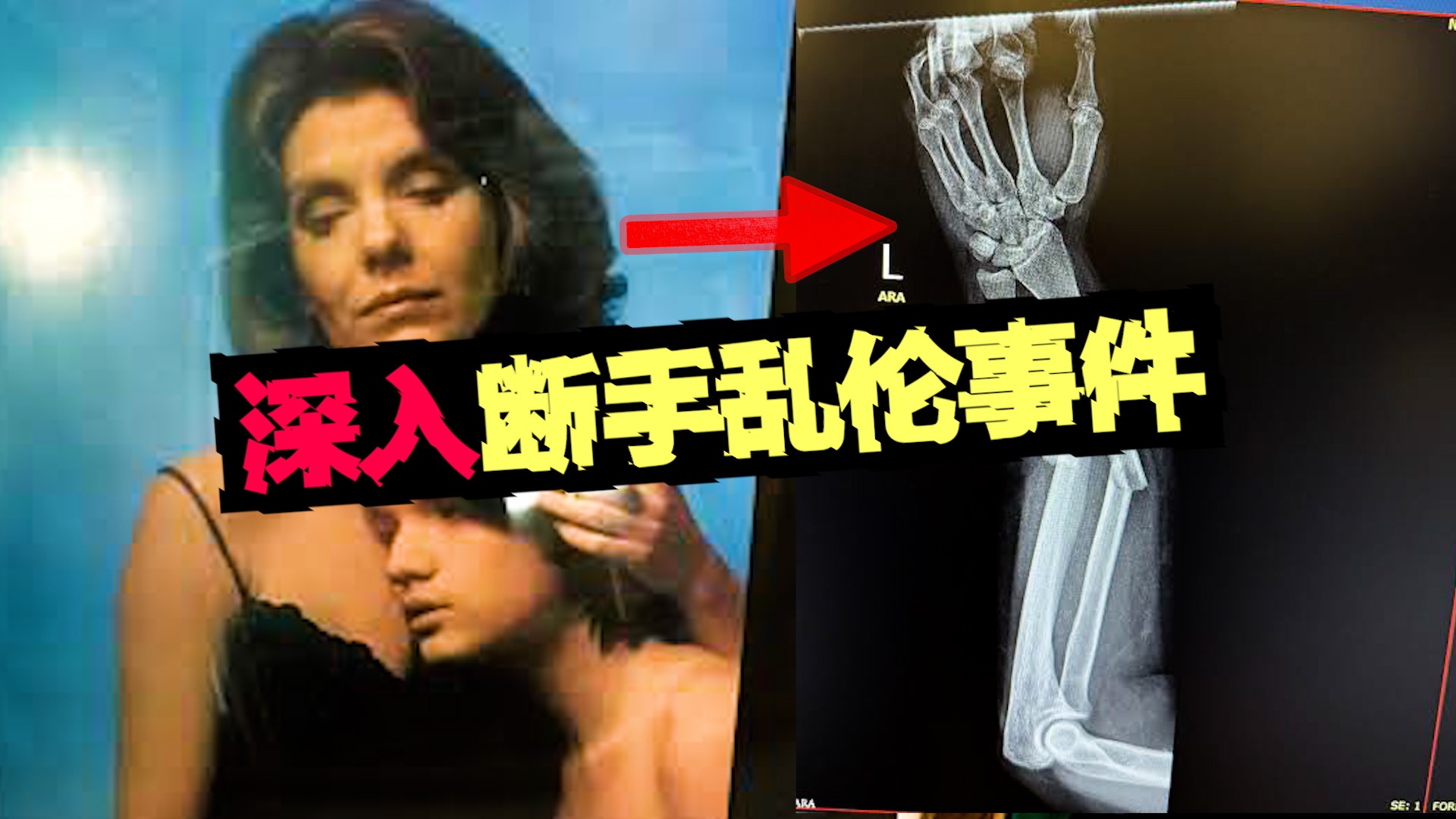【断手邪典】母亲满足断手儿子的冲动，分享网友真实母子乱伦。。。