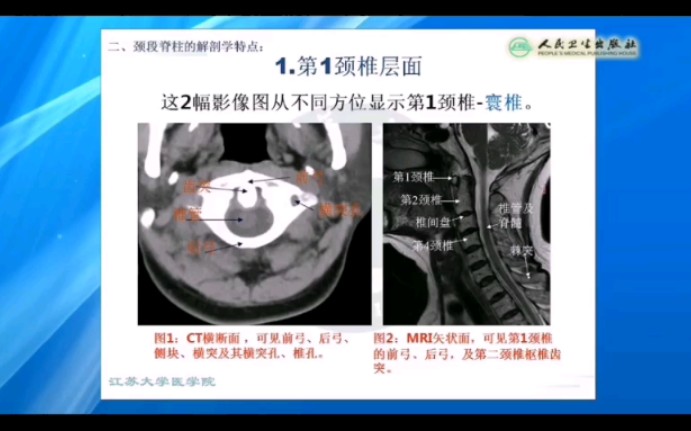 [图]【系统解剖学】颈段脊柱的断层解剖