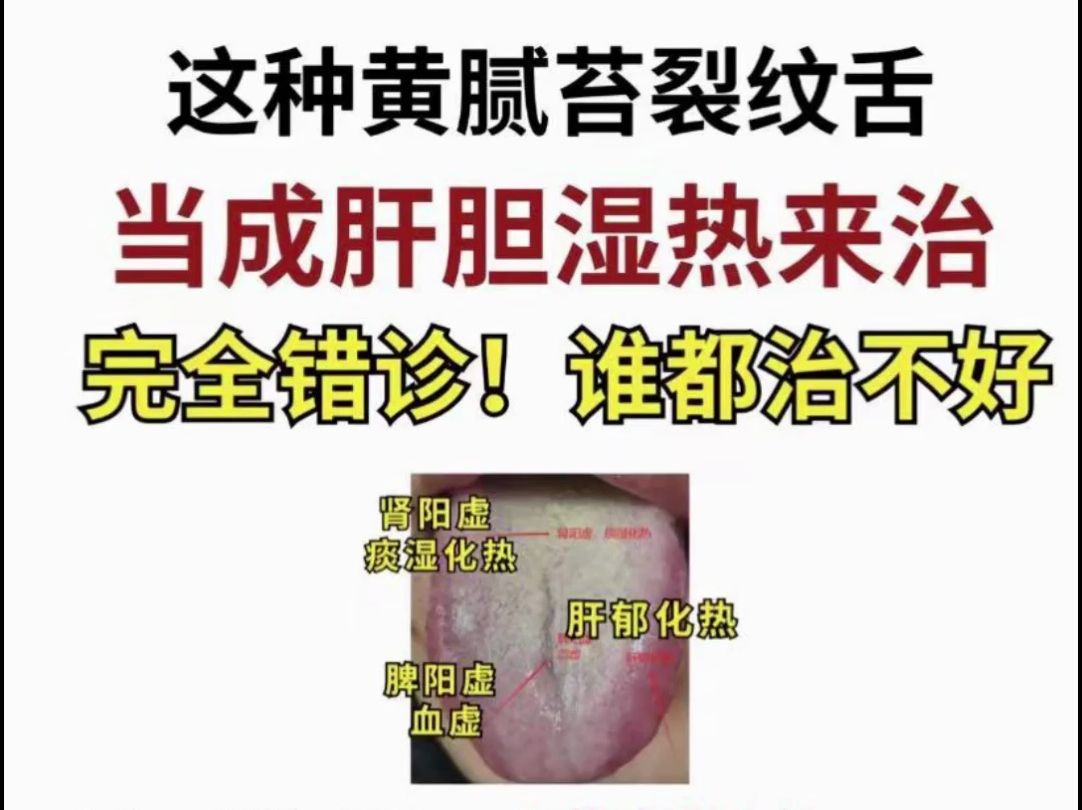 肝胆湿热医案(肝热脾湿的症状)