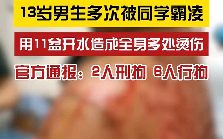 广西龙翔学校“泼开水事件”,一学生被几位霸凌者连泼11盆开水全身烫伤毁容.哔哩哔哩bilibili