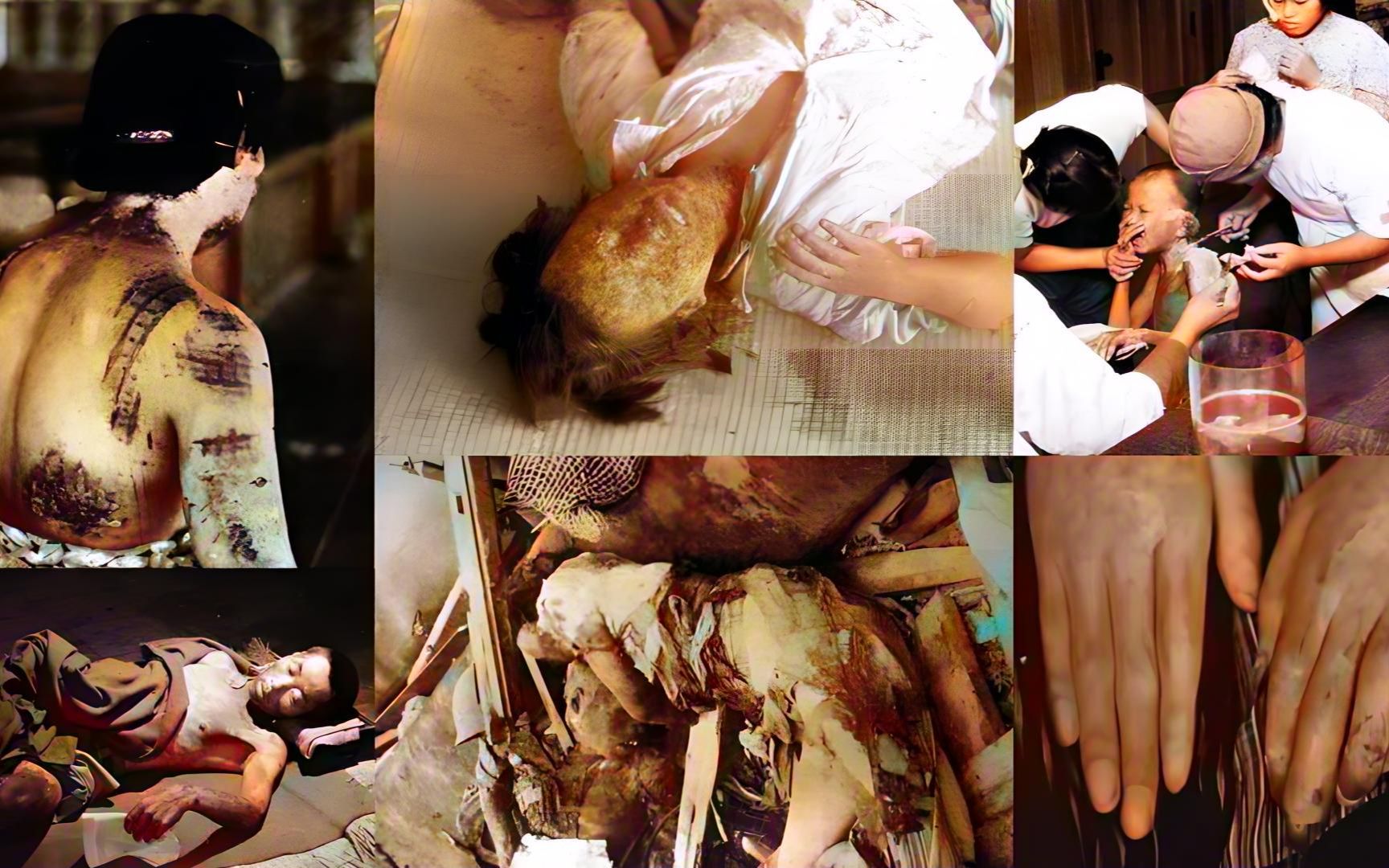 1945年,广岛原子弹爆炸后真实录像,人被瞬间蒸发在地上留下黑影