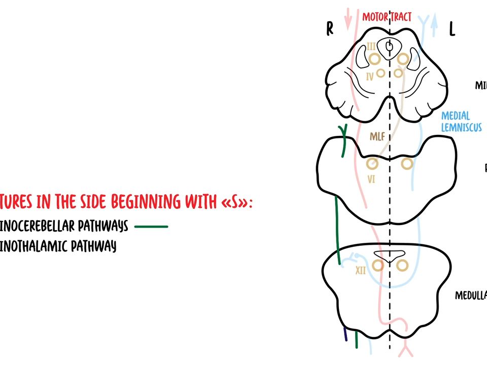 腦幹解剖the brainstem clinical anatomy - rule of 4s, midbrain