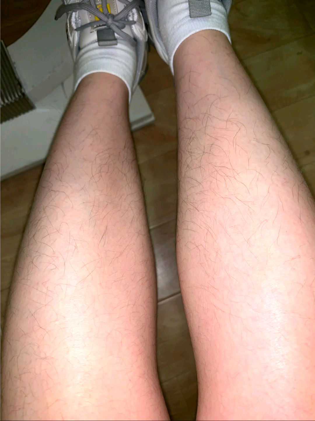 这腿是挺白的 但是我不想大夏天的穿毛裤呀