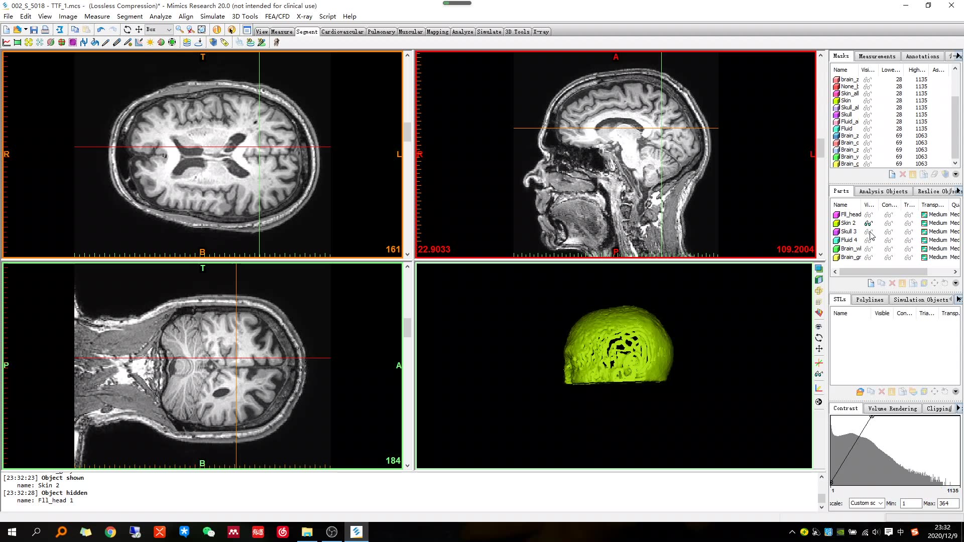 使用mimics进行人体头部建模