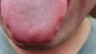 Eichel rote punkte an