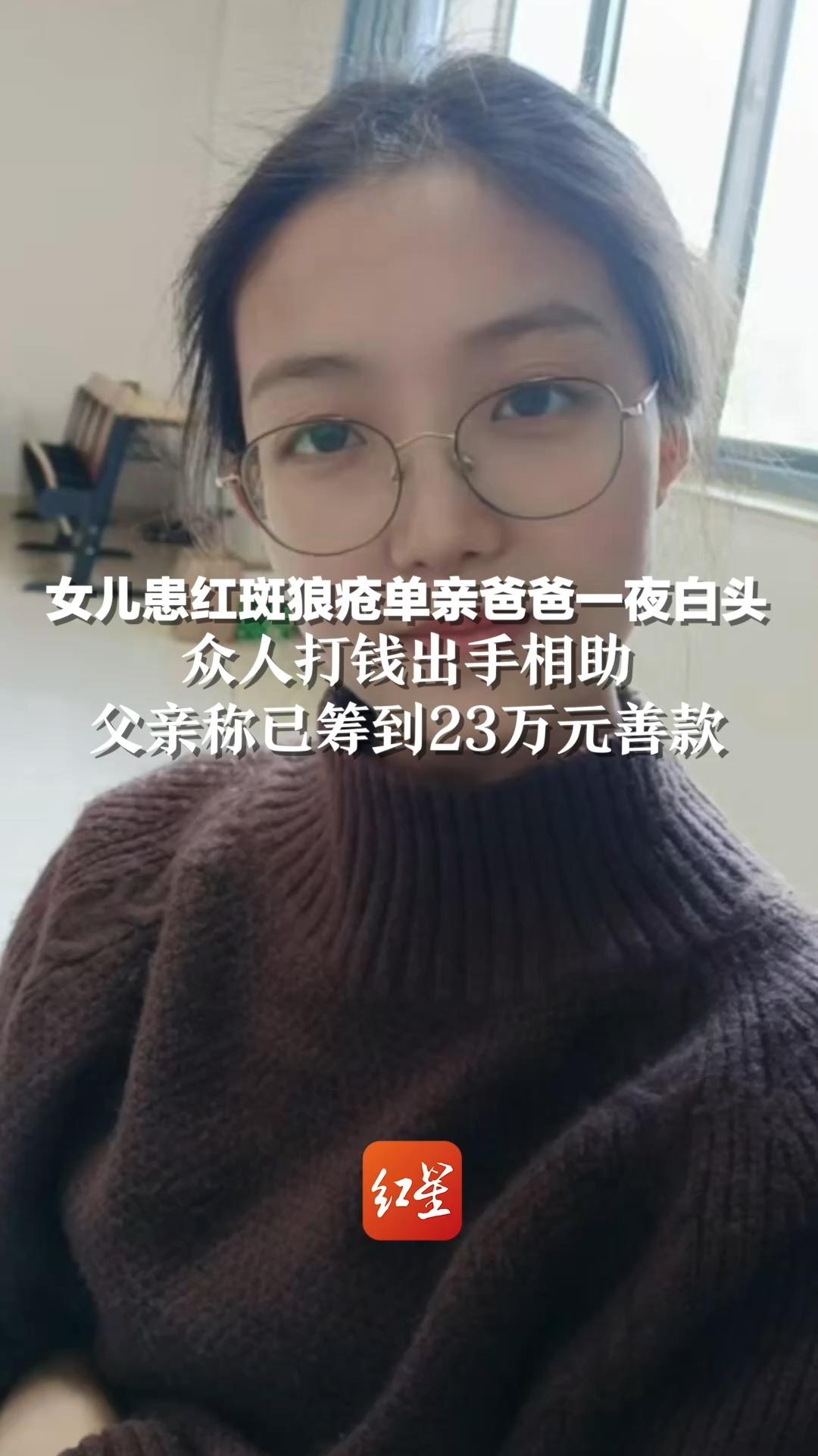 女儿患红斑狼疮单亲爸爸一夜白头,众人打钱出手相助,父亲称已筹到23万元善款哔哩哔哩bilibili