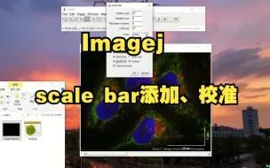 Скачать видео: 用imagej添加scale bar，校准scale bar