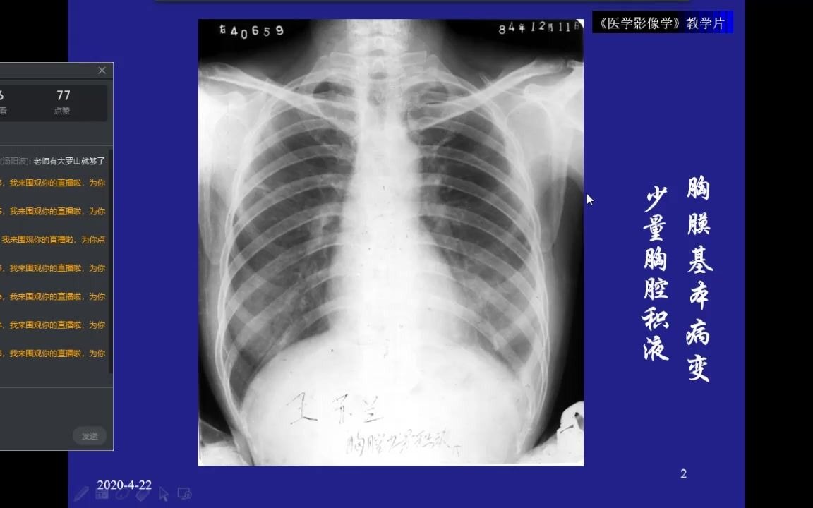 [图]温州医科大学医学影像诊断学课程（温州附二院陈伟）—呼吸系统影像诊断2