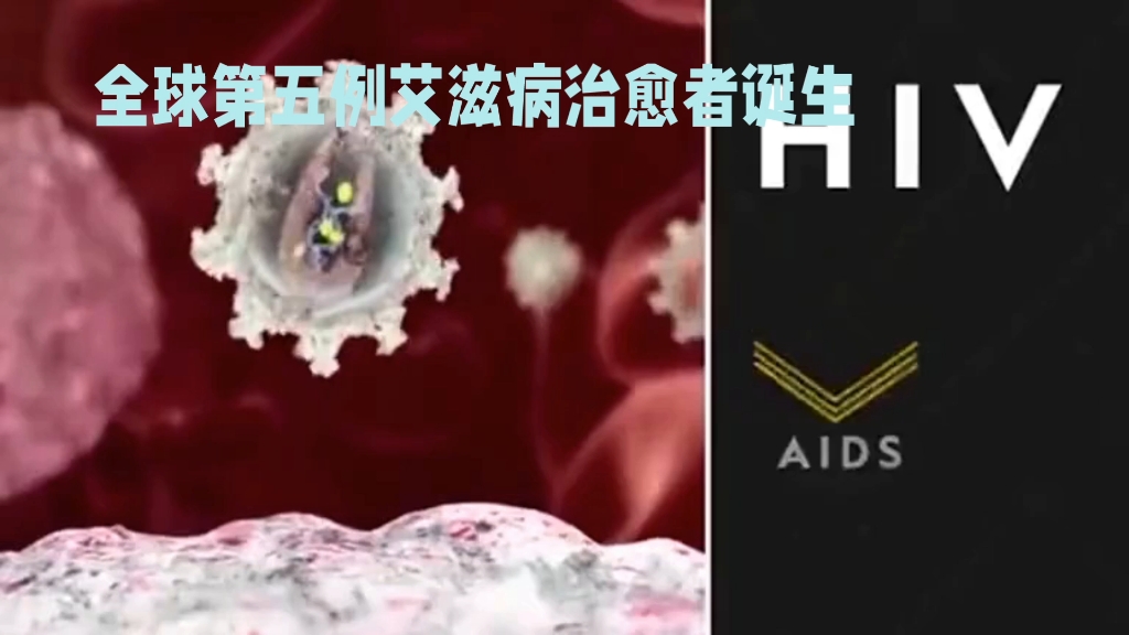 全球第五例艾滋病治愈者诞生