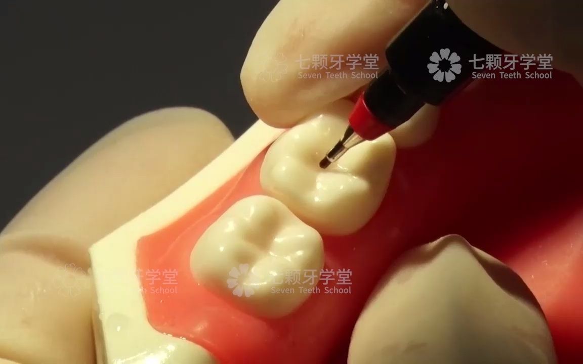 技能考试通关必看磨牙开髓术七颗牙七颗牙学堂口腔医师资格考试