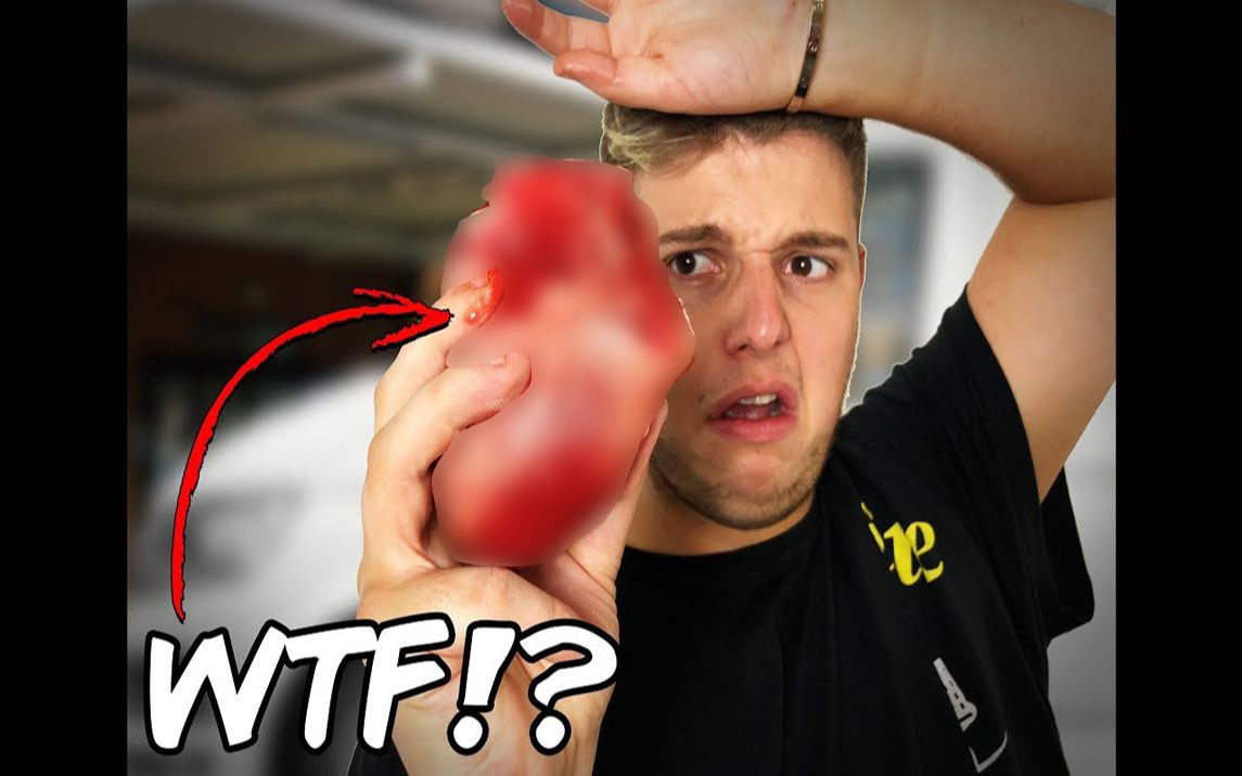 中英字幕我的人类心脏youtubebenphillips