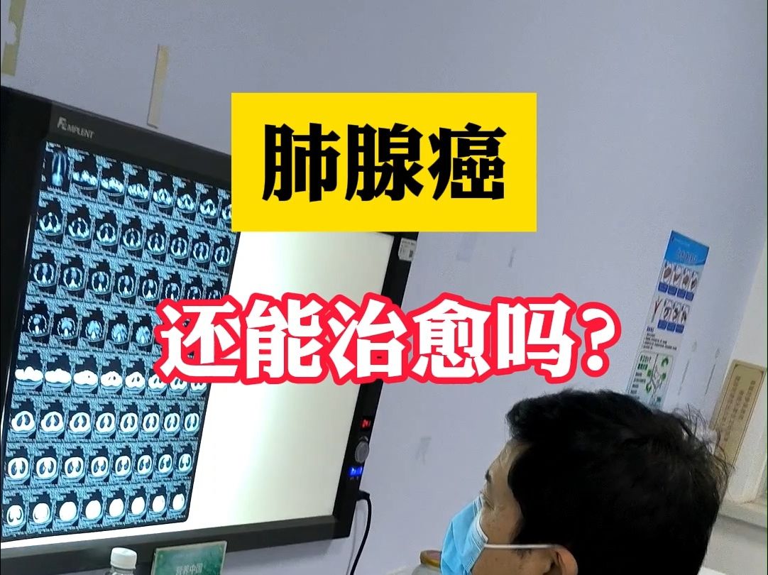 肺腺癌能治愈吗?哔哩哔哩bilibili