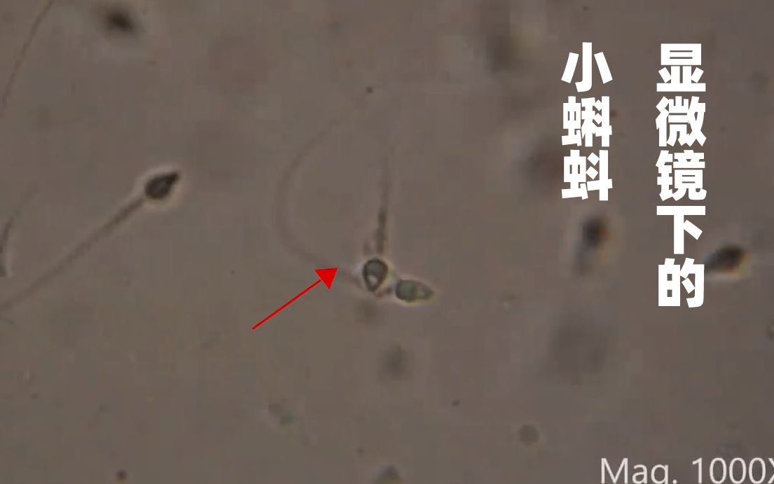 显微镜下的 精子 游来游去的 ,它们有思维吗? 1分27秒是打架吗?哔哩哔哩bilibili