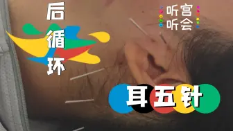 Download Video: 突发性耳鸣 | 五针解决