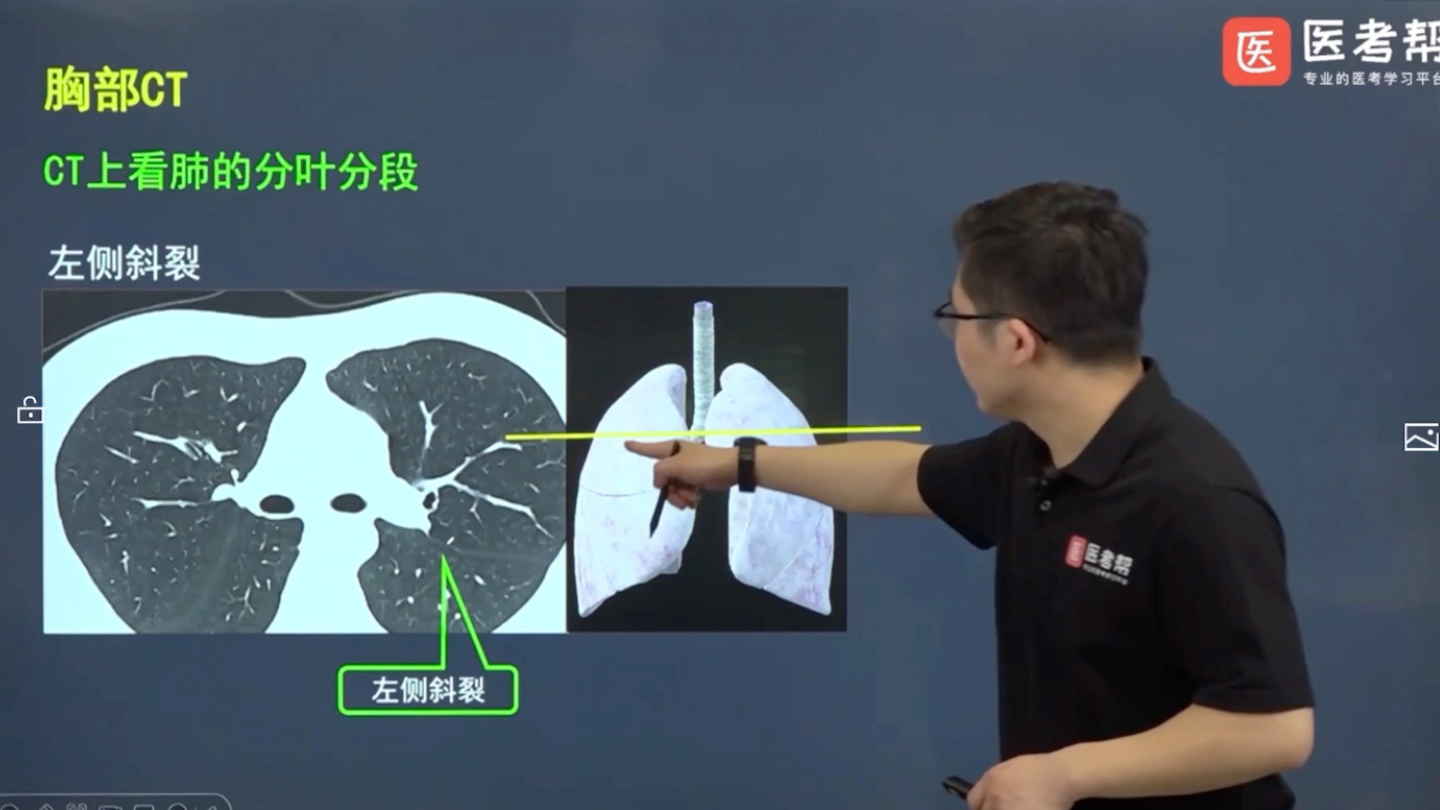 肺部CT之肺的分叶分段(2)哔哩哔哩bilibili