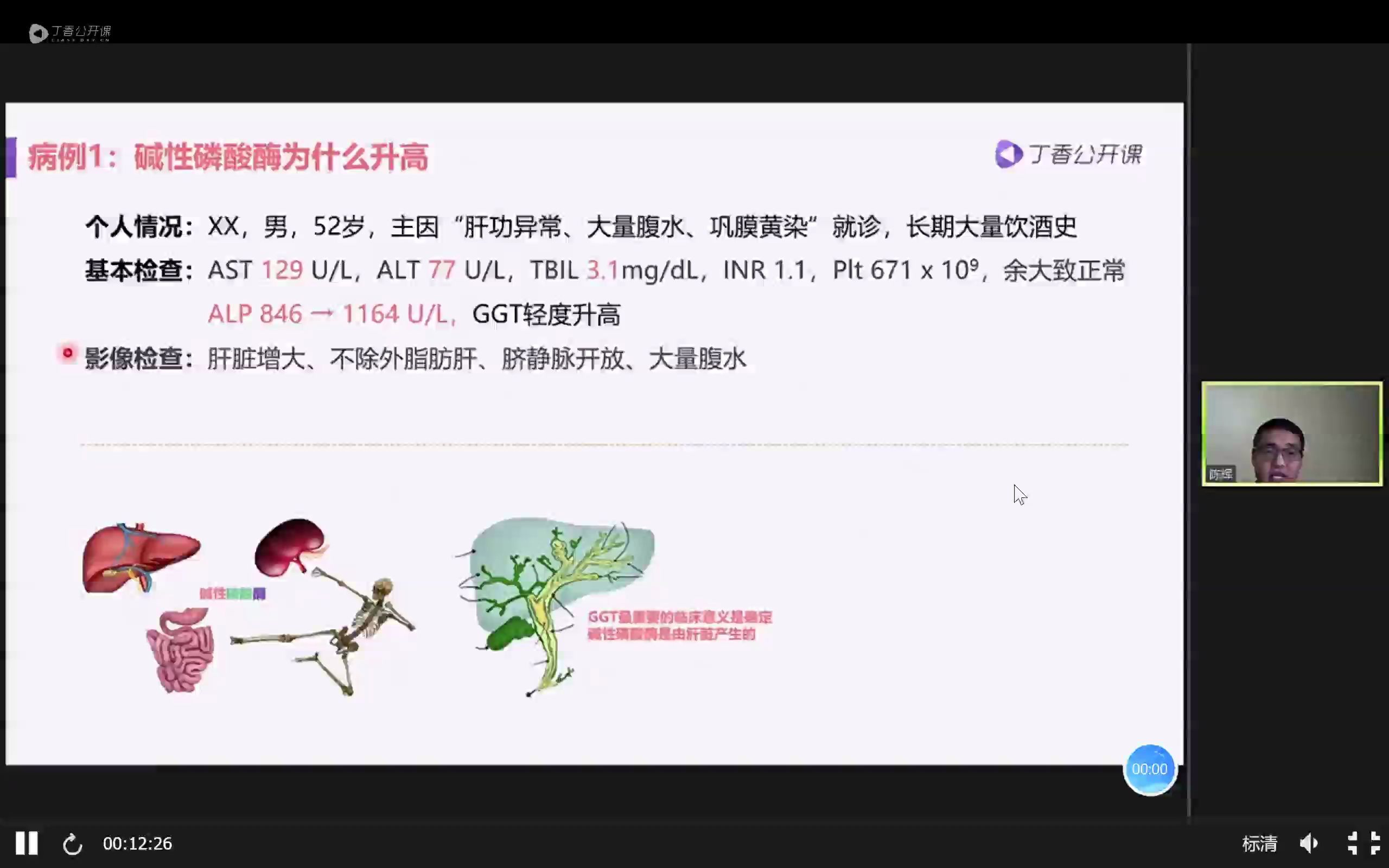 肝脏生化指标学习哔哩哔哩bilibili