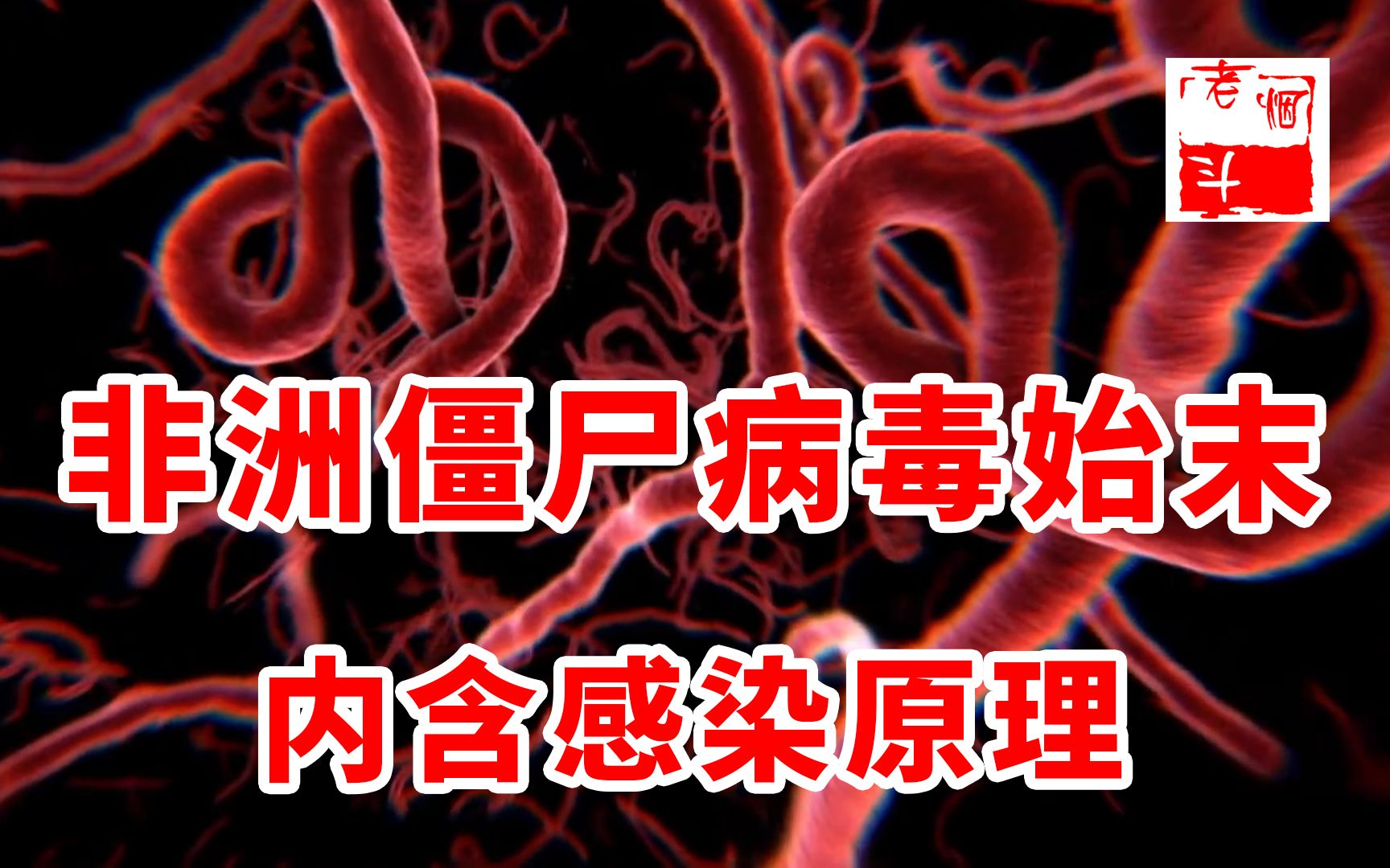 [图]1976年‘僵尸病毒’事件！生物安全等级4级，力压艾滋病和鼠疫的埃博拉有多可怕？！内含感染过程！