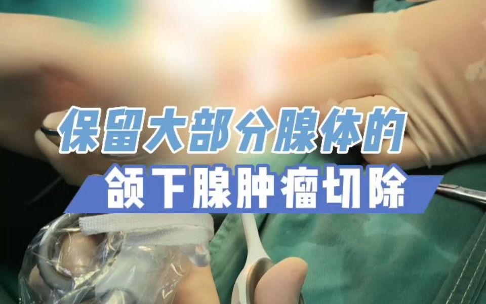 保留大部分腺体的颌下腺肿瘤手术哔哩哔哩bilibili