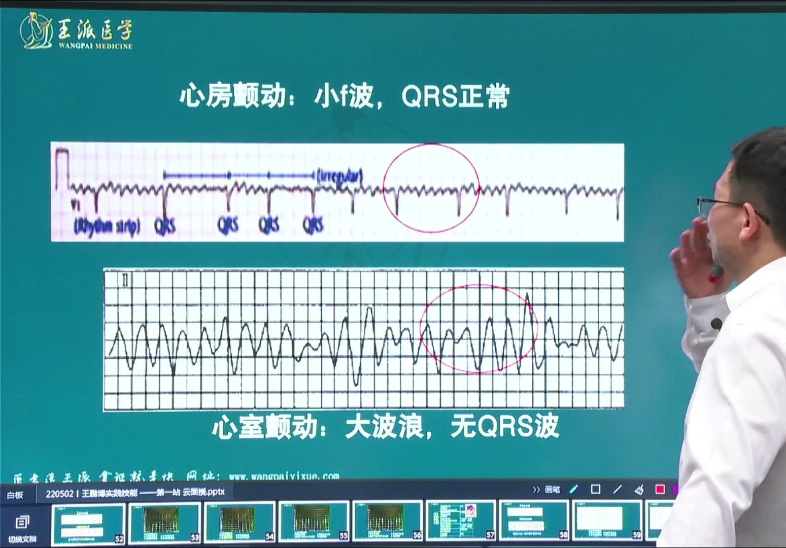 王博心电图医考必考点专讲房颤和室颤哔哩哔哩bilibili