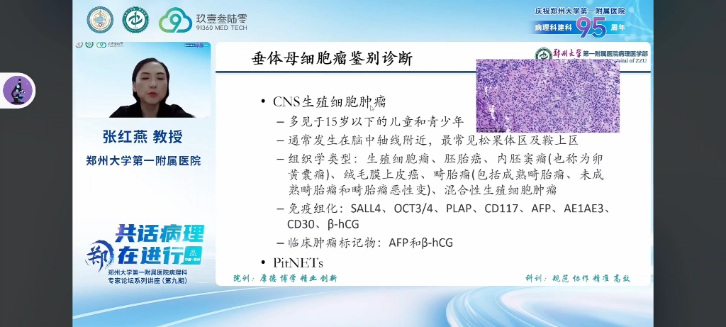 鞍区肿瘤PPT图片