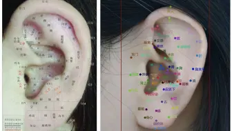 中医+人工智能黑科技：耳朵穴位经络图像识别