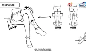 Download Video: 翘二郎腿的危害多大？