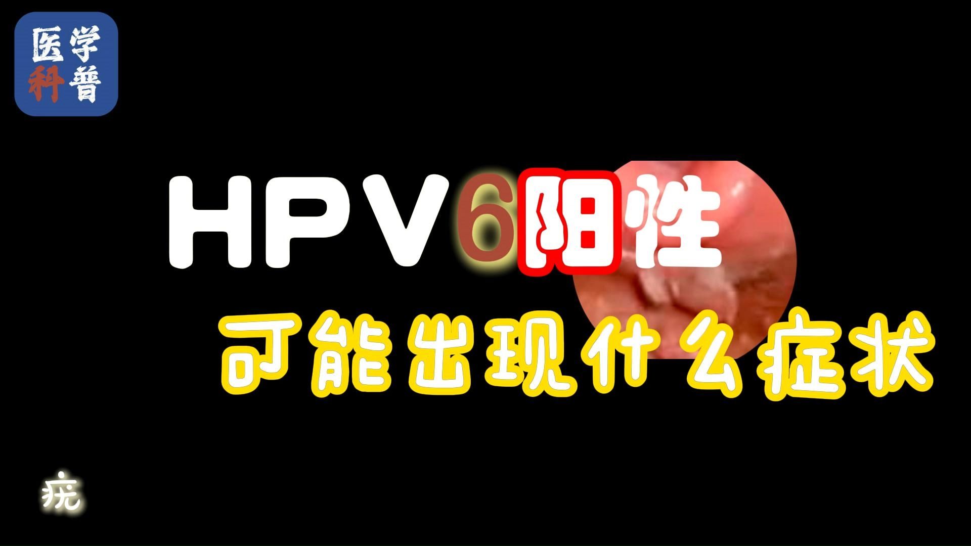 男性得了hpv有什么症状图片